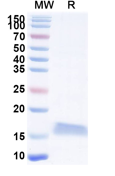 SDS-PAGE for Anti-SARS-CoV-2 S Protein VHH (SAA1070)