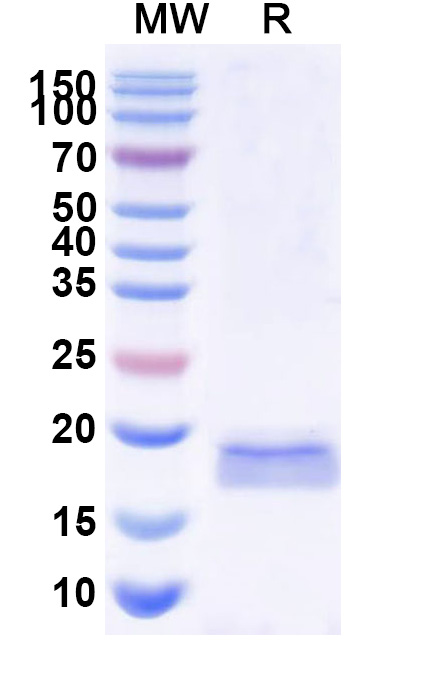 SDS-PAGE for Anti-SARS-CoV-2 S Protein VHH (SAA1071)