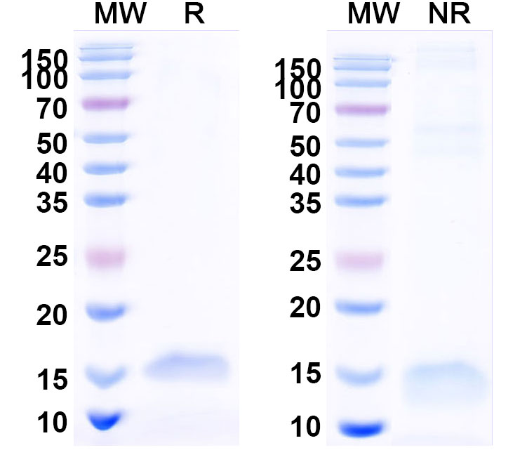 SDS-PAGE for Anti-SARS-CoV-2 S Protein VHH (SAA1072)