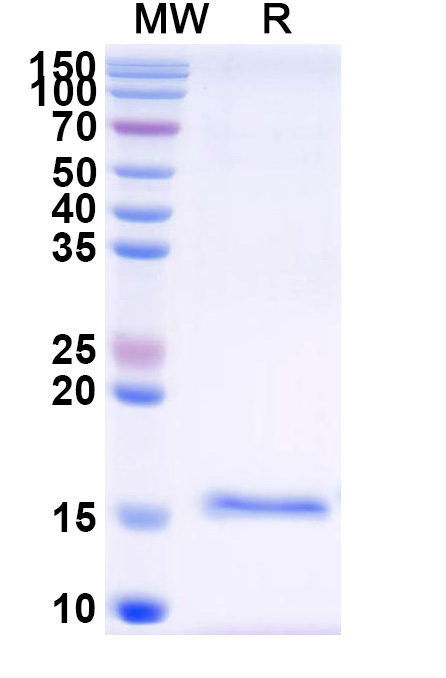 SDS-PAGE for Anti-SARS-CoV-2 S Protein VHH (SAA1075)