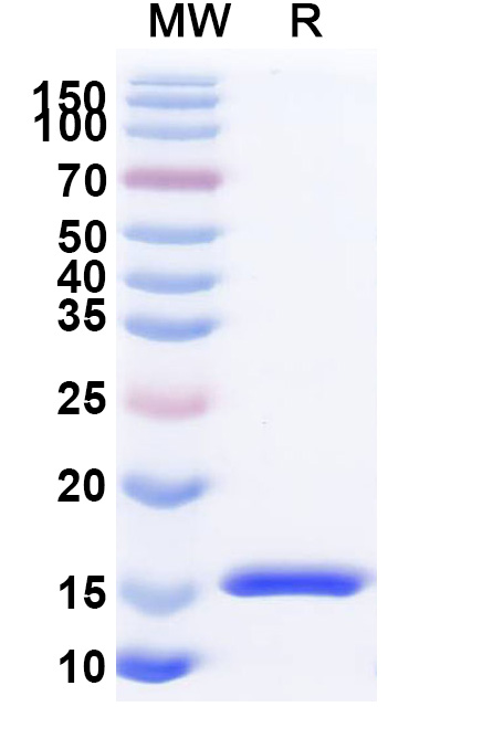 SDS-PAGE for Anti-SARS-CoV-2 S Protein VHH (SAA1076)