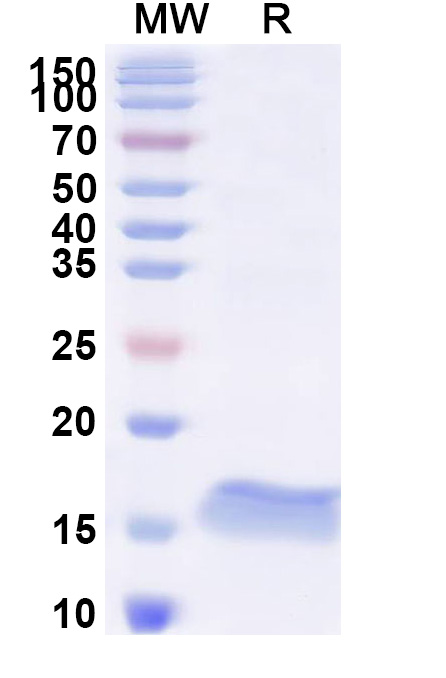 SDS-PAGE for Anti-SARS-CoV-2 S Protein VHH (SAA1081)