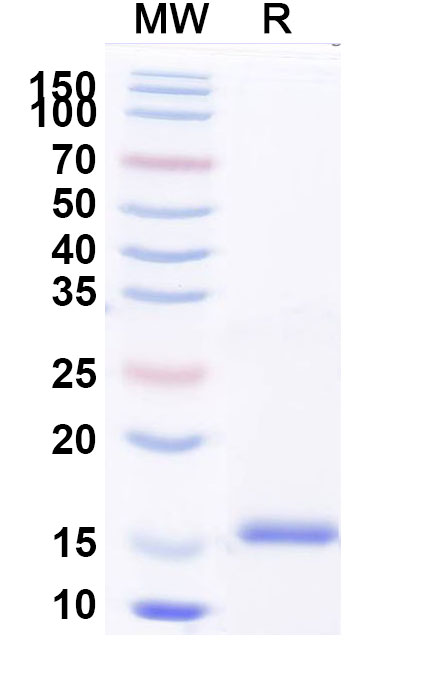 SDS-PAGE for Anti-SARS-CoV-2 S Protein VHH (SAA1089)