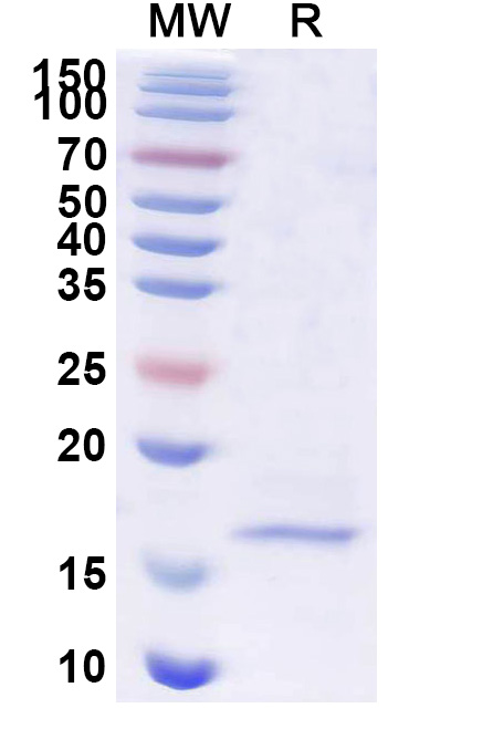 SDS-PAGE for Anti-SARS-CoV-2 S Protein VHH (SAA1099)