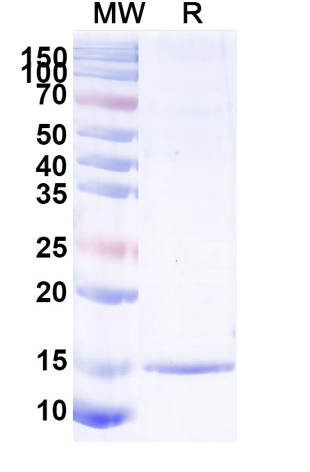 SDS-PAGE for Anti-SARS-CoV-2 S Protein VHH (SAA1100)