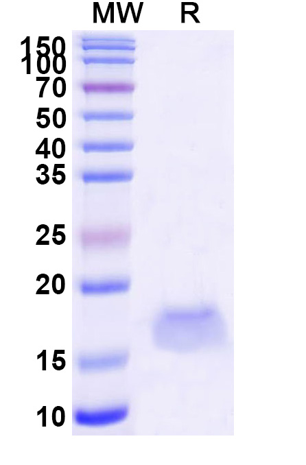SDS-PAGE for Anti-SARS-CoV-2 S Protein VHH (SAA1102)