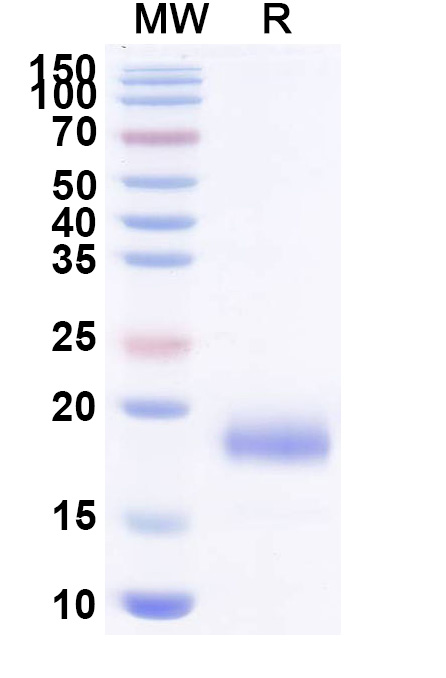 SDS-PAGE for Anti-SARS-CoV-2 S Protein VHH (SAA1103)
