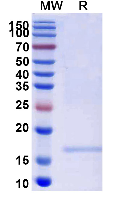 SDS-PAGE for Anti-SARS-CoV-2 S Protein VHH (SAA1105)