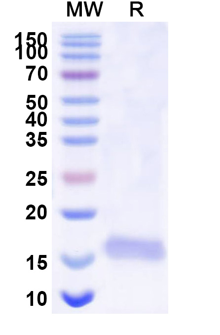 SDS-PAGE for Anti-SARS-CoV-2 S Protein VHH (SAA1108)