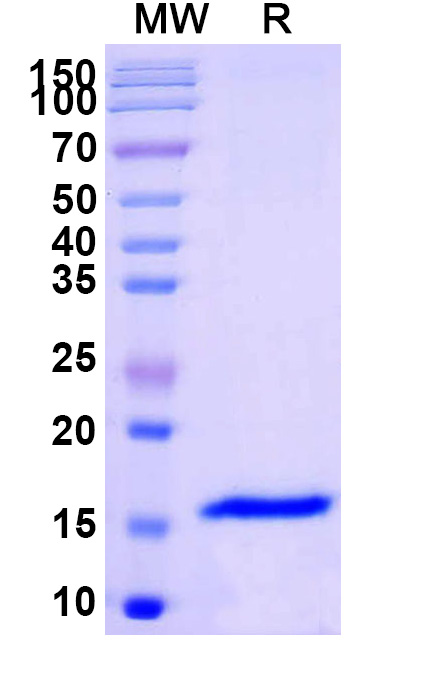 SDS-PAGE for Anti-SARS-CoV-2 S Protein VHH (SAA1109)