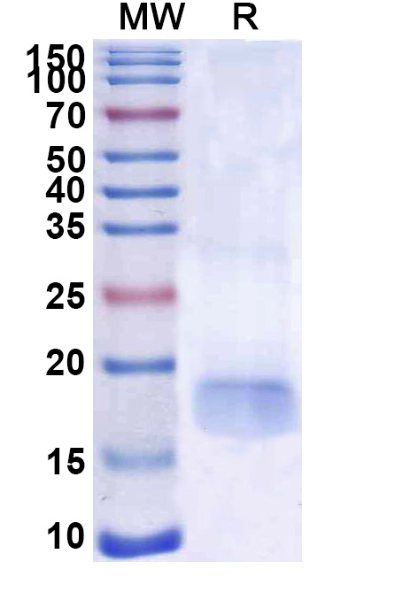 SDS-PAGE for Anti-SARS-CoV-2 S Protein VHH (SAA1110)
