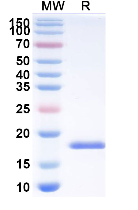 SDS-PAGE for Anti-SARS-CoV-2 S Protein VHH (SAA1122)