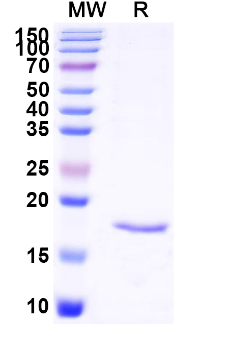 SDS-PAGE for Anti-SARS-CoV-2 S Protein VHH (SAA1123)