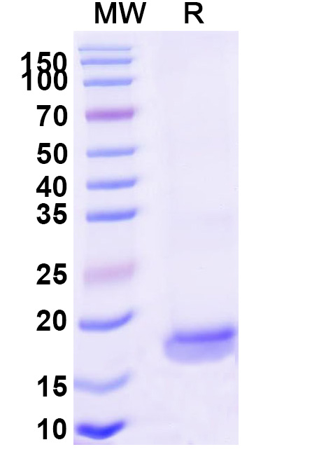 SDS-PAGE for Anti-SARS-CoV-2 S Protein VHH (SAA1124)