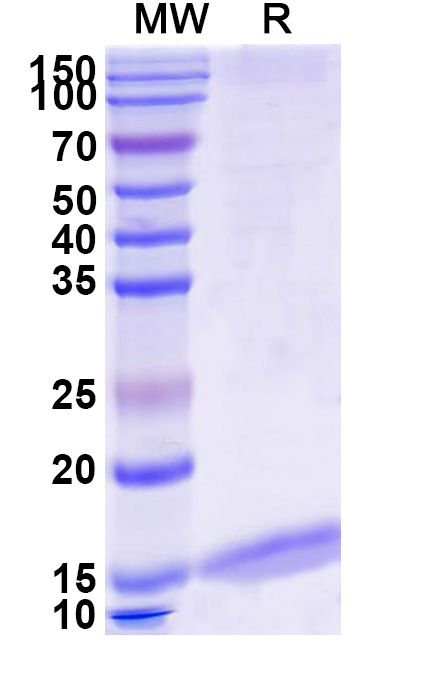 SDS-PAGE for Anti-SARS-CoV S/Spike glycoprotein VHH (SAA1009)