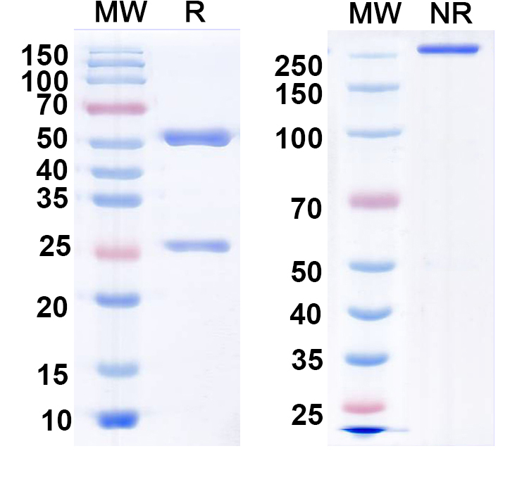 SDS-PAGE for Anti-SRGAP2 Antibody (N281/1)