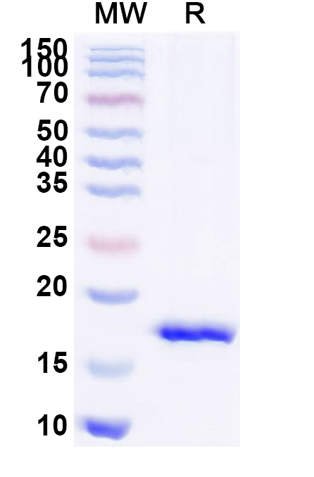 SDS-PAGE for Anti-Staphylococcus aureus entB/SEB VHH (SAA1238)
