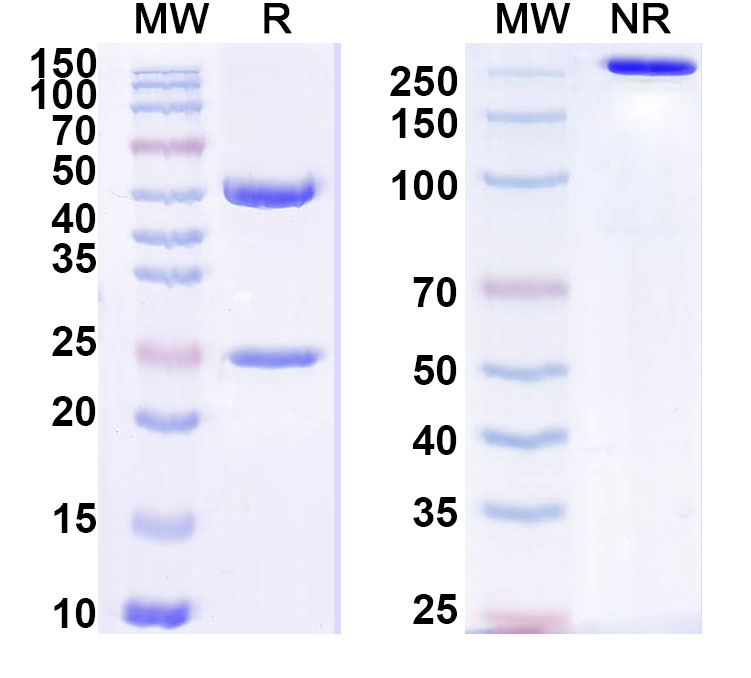 SDS-PAGE for Anti-Staphylococcus aureus nuc/Thermonuclease Antibody (SAA1454)