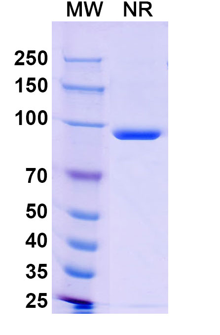 SDS-PAGE for Anti-Sudan ebolavirus/SEBOV NP/Nucleoprotein Antibody (SAA1402)