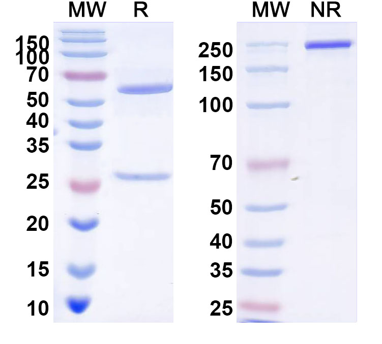 SDS-PAGE for Anti-Trypanosoma cruzi TS/Trans-sialidase Antibody (13G9)