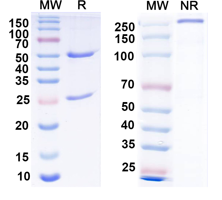 SDS-PAGE for Anti-Vaccinia virus/VACV B5R Antibody (SAA0315)