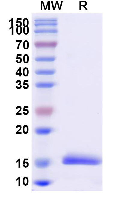 SDS-PAGE for Anti-Vesicular stomatitis Indiana virus/VSIV NP/Nucleoprotein VHH (SAA1125)