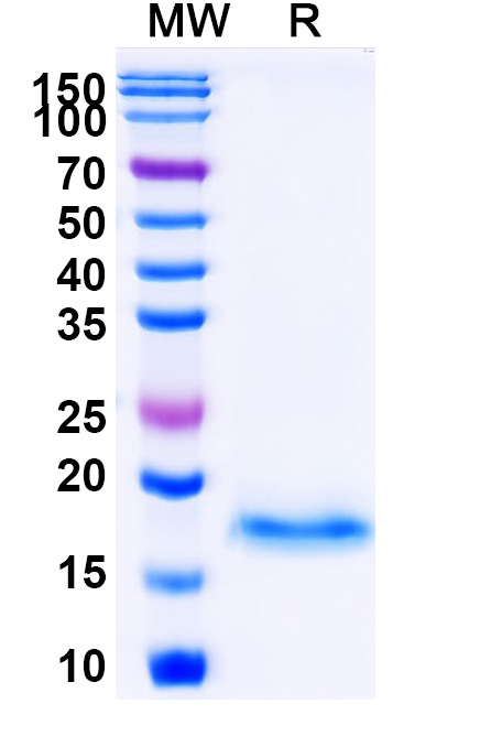 SDS-PAGE for Anti-Vesicular stomatitis Indiana virus/VSIV NP/Nucleoprotein VHH (SAA1193)