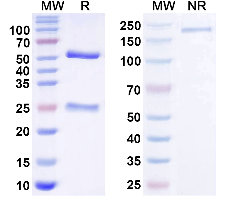SDS-PAGE for Anti-Vibrio cholerae ctxB/Cholera Toxin Subunit B Monoclonal Antibody, TE33