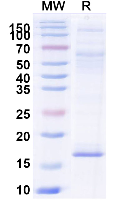SDS-PAGE for Anti-Vibrio cholerae higB-2 VHH (SAA0852)
