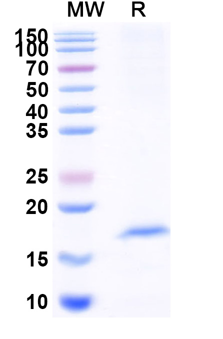 SDS-PAGE for Anti-Vibrio cholerae serotype O1 ctxB/Cholera Toxin Subunit B VHH (SAA1345)