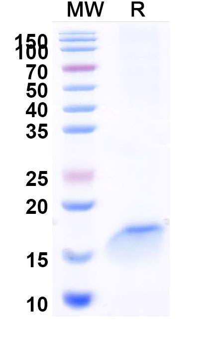 SDS-PAGE for Anti-Vibrio cholerae serotype O1 higB-2 VHH (SAA0877)