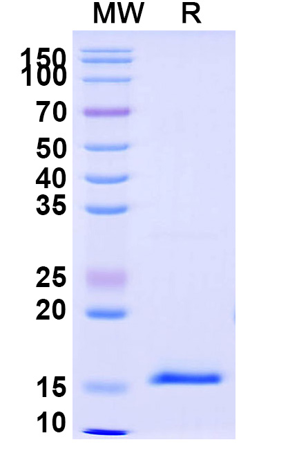 SDS-PAGE for Anti-Vibrio cholerae serotype O1 higB-2 VHH (SAA1029)