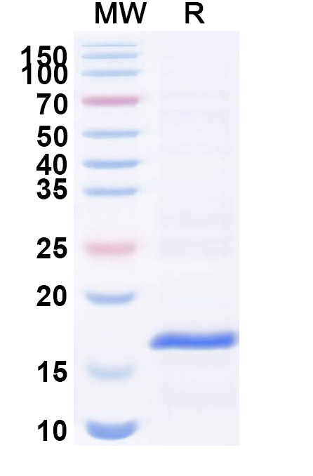 SDS-PAGE for Anti-Vibrio cholerae serotype O1 higB-2 VHH (SAA1035)