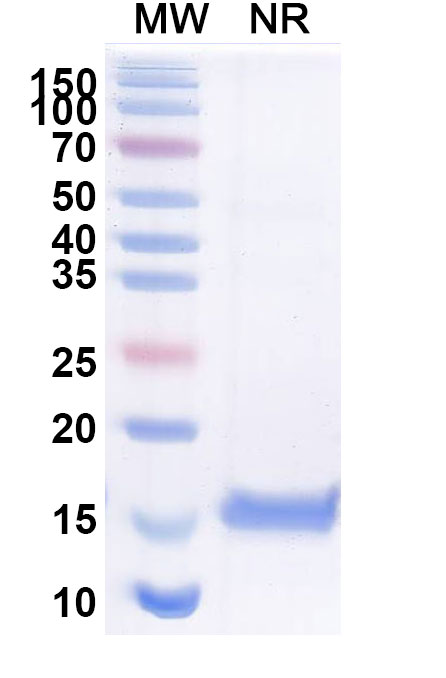 SDS-PAGE for Anti-Vibrio cholerae serotype O1 higB-2 VHH (SAA1174)