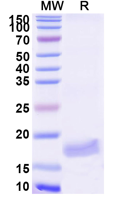 SDS-PAGE for Anti-Zika Virus Envelope protein E VHH&reg; (SAA2297)