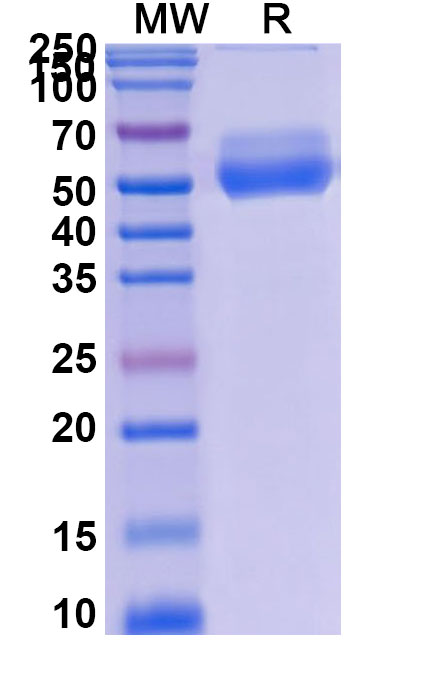 SDS-PAGE for Research Grade Asunercept