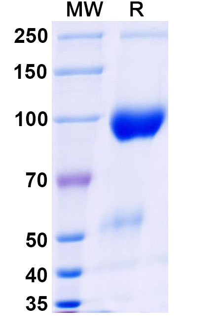 SDS-PAGE for Research Grade Belatacept