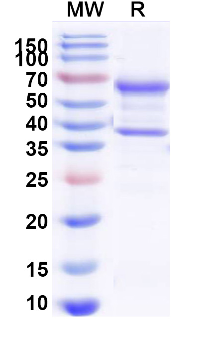 SDS-PAGE for beta-nerve growth factor(NGF)