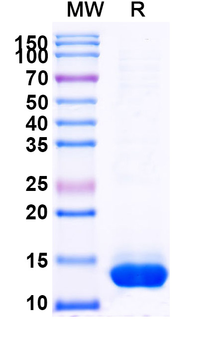 SDS-PAGE for BID Protein - BH3-interacting domain death agonist(BID)