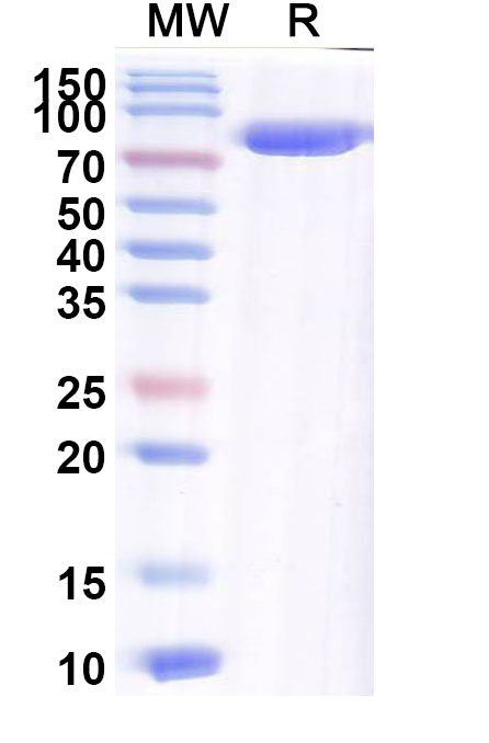 SDS-PAGE for Border disease virus (BDV) Glycoprotein E2 Recombinant Protein, C-Fc