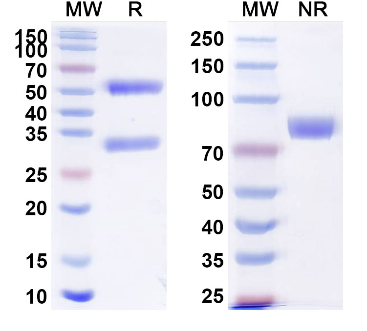 SDS-PAGE for bovine Influenza A virus (H5N1) HA/Hemagglutinin Recombinant Protein, C-His
