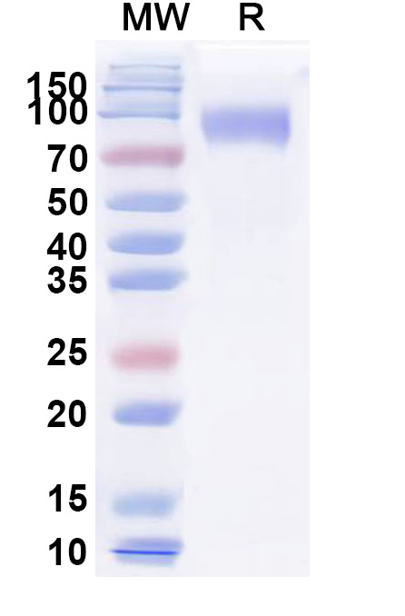 SDS-PAGE for Cat CD117 recombinant protein