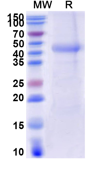 SDS-PAGE for CD116 / CSF2RA, C-His, recombinant protein