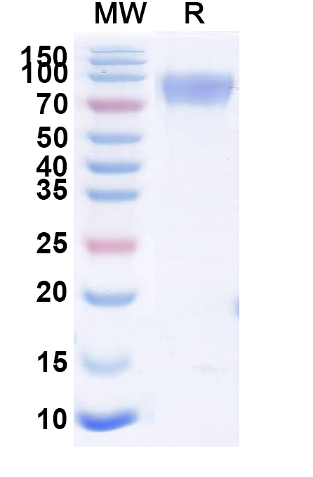 SDS-PAGE for CD117 Recombinant Protein