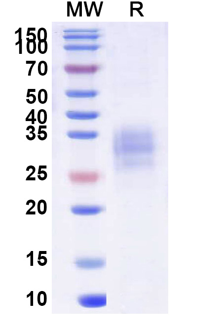 SDS-PAGE for CD120a Recombinant Protein