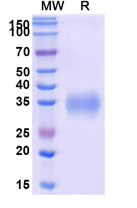 SDS-PAGE for CD2 Recombinant Protein