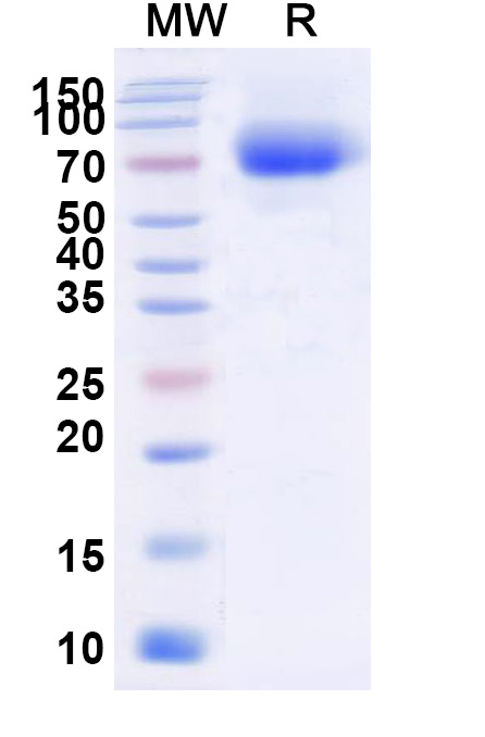 SDS-PAGE for CD333 / FGFR3, C-His, recombinant protein