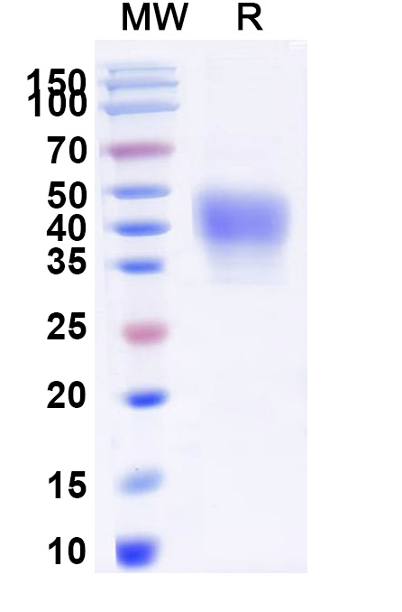 SDS-PAGE for CD38 Recombinant Protein