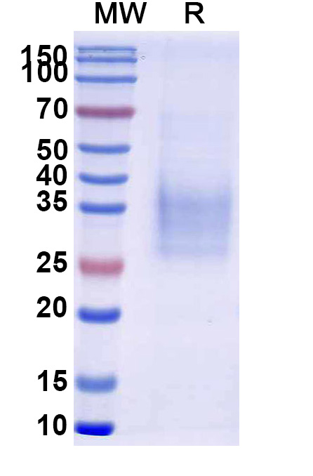SDS-PAGE for CD47 Recombinant Protein (Human)