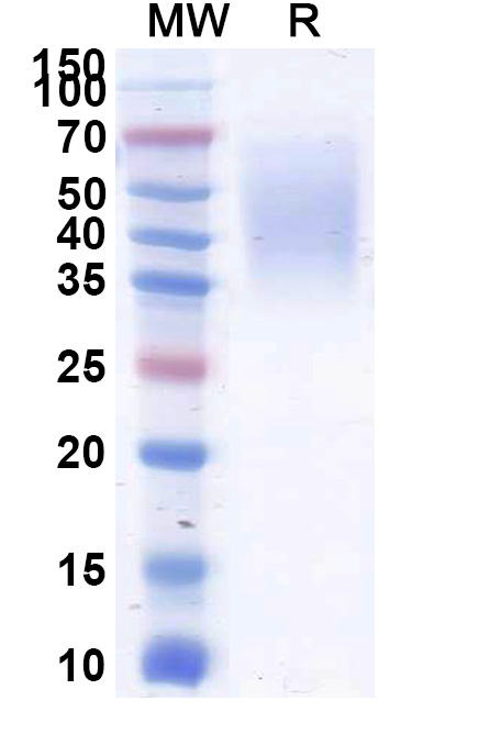 SDS-PAGE for CD58 Recombinant Protein